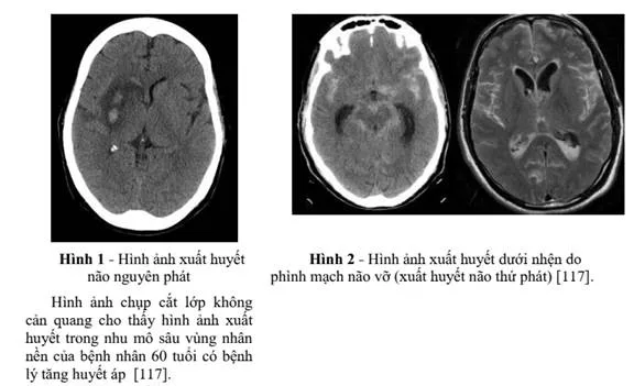 Định Lý Turan: Nền Tảng Của Lý Thuyết Đồ Thị Cực Trị Và Các Hướng Chứng Minh Chuyên Sâu