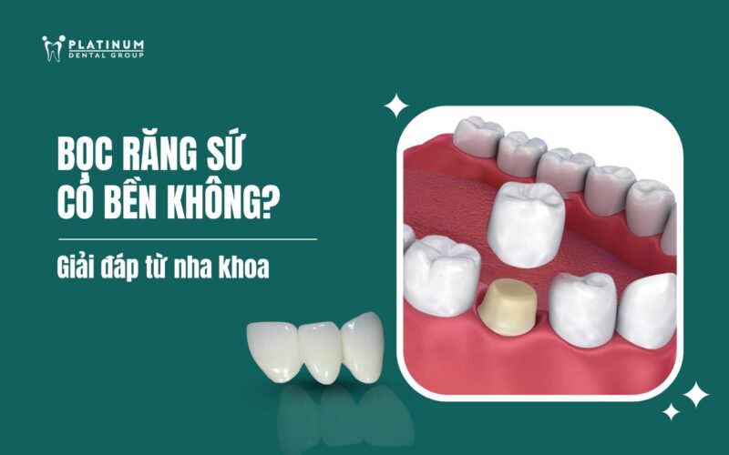 Giải Pháp Giữ Gìn Sự Trong Sáng Của Tiếng Việt: Liên Hệ Thực Tiễn