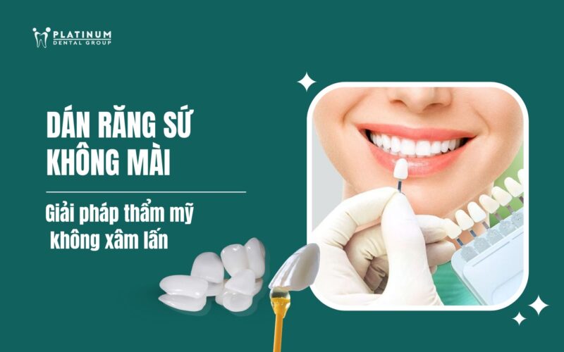 Giải Toán Hình Lớp 6: Phương Pháp Hiệu Quả Đạt Điểm Tuyệt Đối