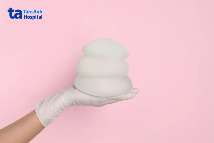 phương pháp phẫu thuật nâng ngực