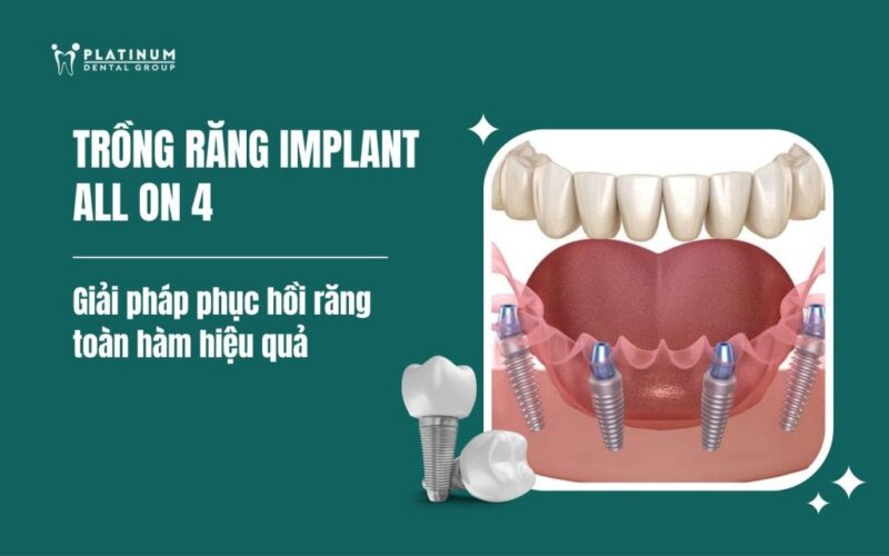 Giải Toán Hình Lớp 6: Phương Pháp Hiệu Quả Đạt Điểm Tuyệt Đối